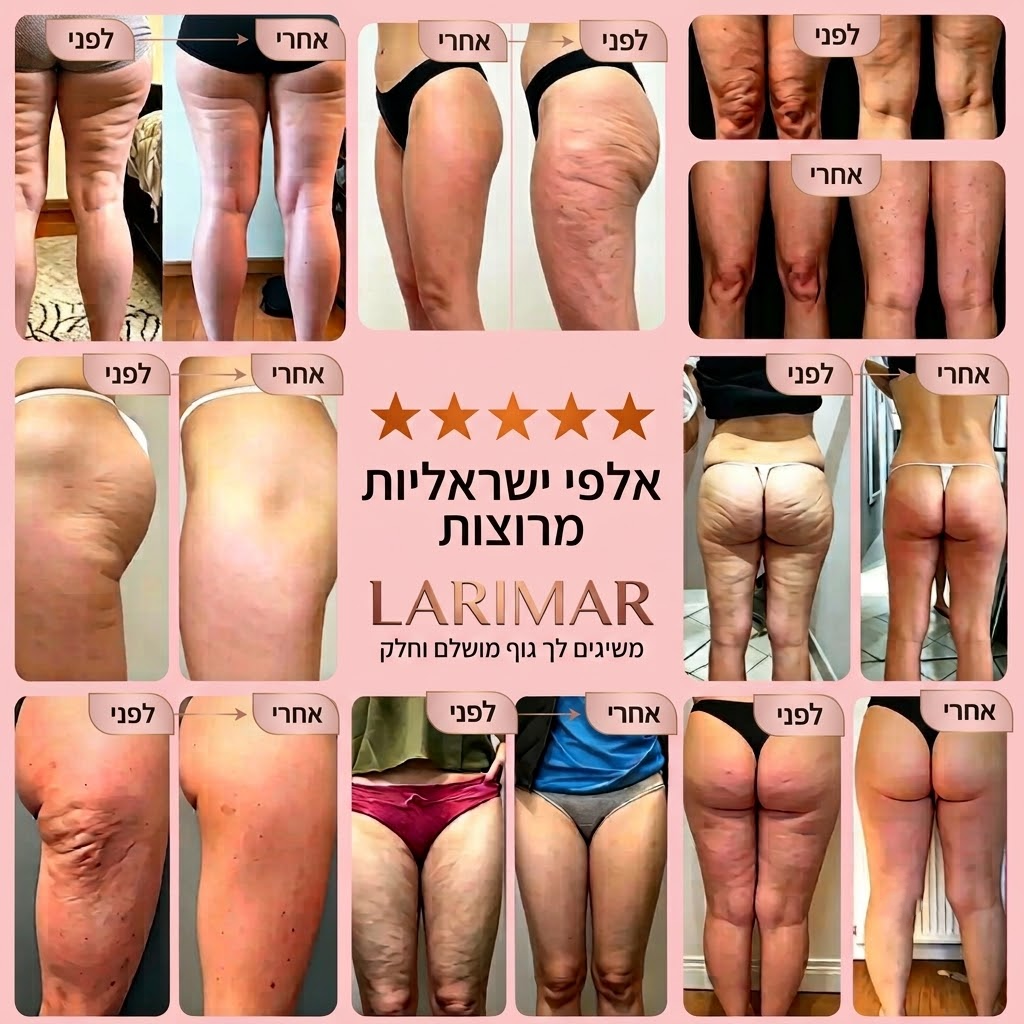 ערכה ביתית להפחתת הצלוליטיס 